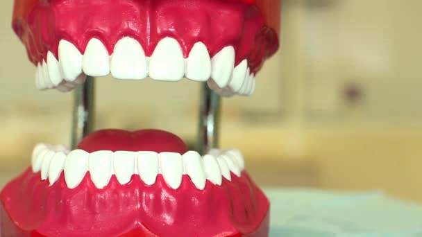 Tratamento dentário no exemplo da mandíbula do brinquedo — Vídeo de Stock