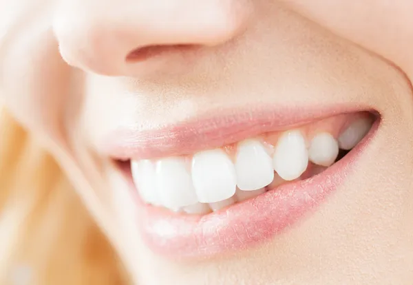 Beautiful Smile — Stock Photo, Image