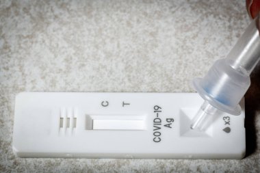 Corona virüs test kiti paneli çözüm eklemeye hazırlanıyor