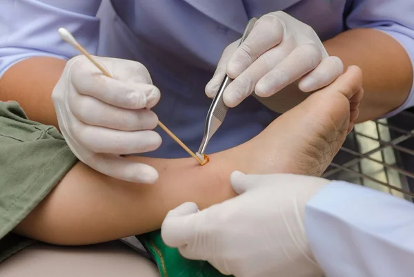 Wundheilung am Bein des Kindes und Liegen im Krankenhausbett — Stockfoto