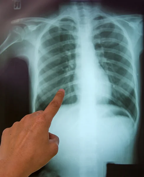Hastanede röntgen sonuçları — Stok fotoğraf