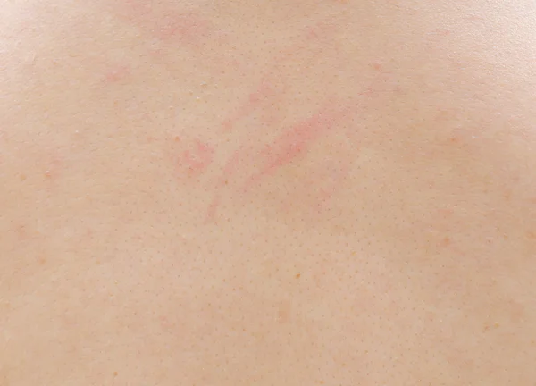Close up view of human skin — Stock Photo, Image