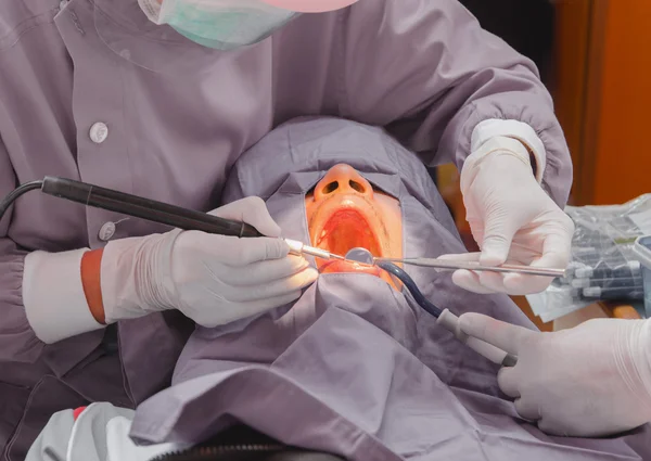 The doctor cleaning the teeth patient with ultrasonic tool — Stock Photo, Image