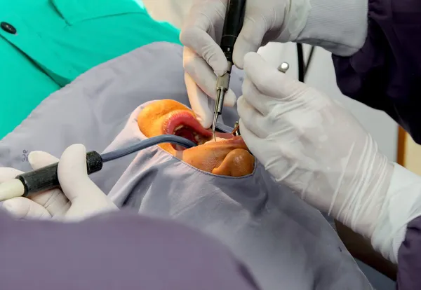 El médico limpiando los dientes paciente con herramienta ultrasónica — Foto de Stock