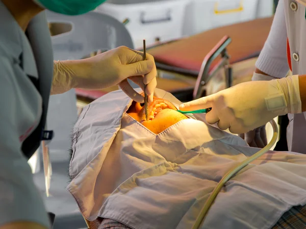 De arts het reinigen van de tanden patiënt met ultrasoon gereedschap — Stockfoto