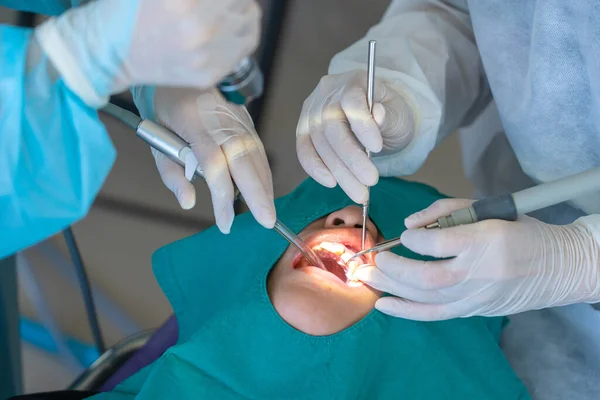 Doctor Cleaning Teeth Patient Ultrasonic Tool — Stock Photo, Image