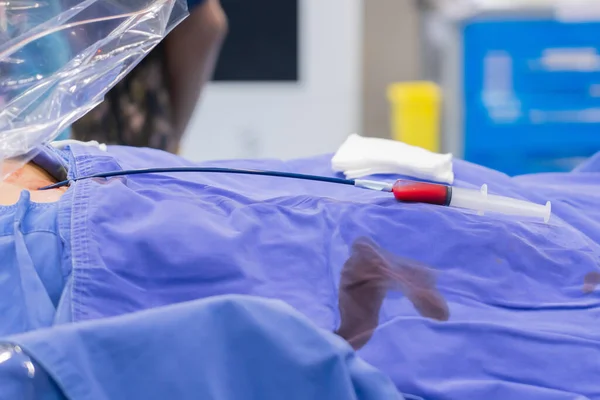 Surgeon Team Working Operating Room Stem Cells Operation Plasma Syringe — Stockfoto