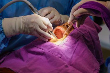 Doktor dişlerini ultrasonik aletle temizliyor. Tartar ve plağın çıkarılması, diş hastalığının önlenmesi paradontit.