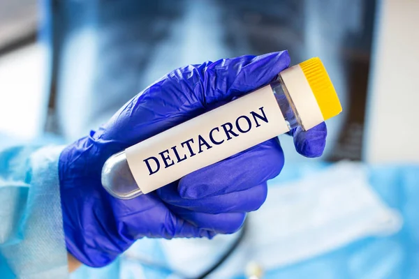 New Infectious Deltacron Variant Coronavirus Desease Delta Omicron Sample Lab — Foto de Stock