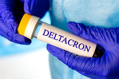 Laboratuvar tüpündeki yeni enfeksiyonlu Coronavirus hastalığı (Delta ve Omicron) numunesi bilim adamının elinde hafif arkaplan üzerine mavi tıbbi eldivenler..