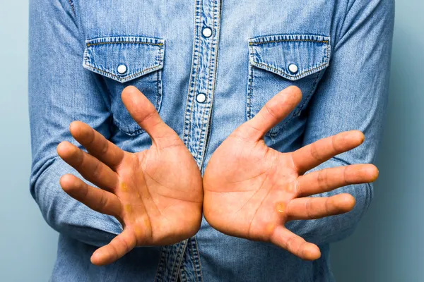 Colarinho azul mostrando suas palmas — Fotografia de Stock