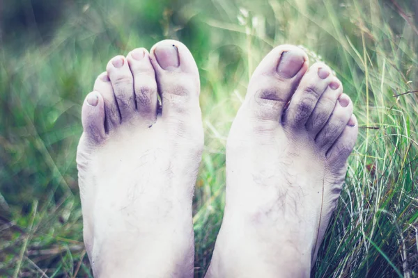 The pale and frozen feet of a young man — Stock Photo, Image