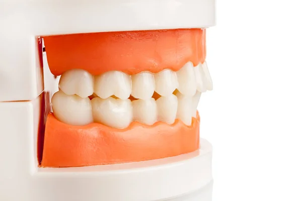 Morsure Orthognathique Correcte Sur Modèle Des Mâchoires Traitement Orthodontique Esthétique — Photo