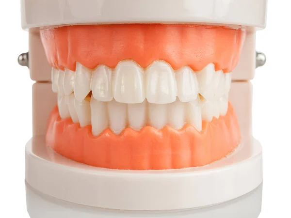 Artificial Model Jaws Teeth Foreground Bite Teeth Correct Orthognathic Bite — Stock Photo, Image