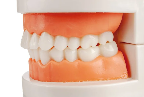 Modèle Artificiel Mâchoire Humaine Morsure Dents Traitement Dentaire Orthognathique Orthodontique — Photo