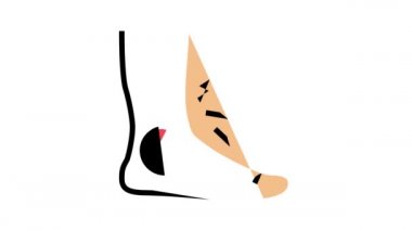 ayak gutu ağrısı semptom rengi canlandırması