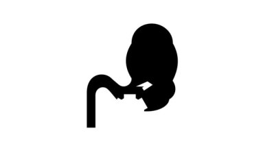 Mide daralması bariatrik sembol canlandırması