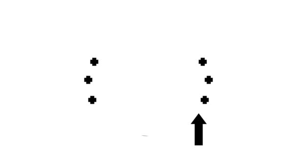 Schilddrüsenunterfunktion endokrinologische Glyphen-Animation — Stockvideo