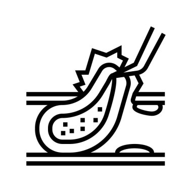 karotid endarterektomi çizgi simgesi çizimi