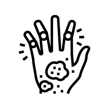 sedef hastalığı eklem iltihabı, deri sağlığı problemi çizgi ikon vektör illüstrasyonu