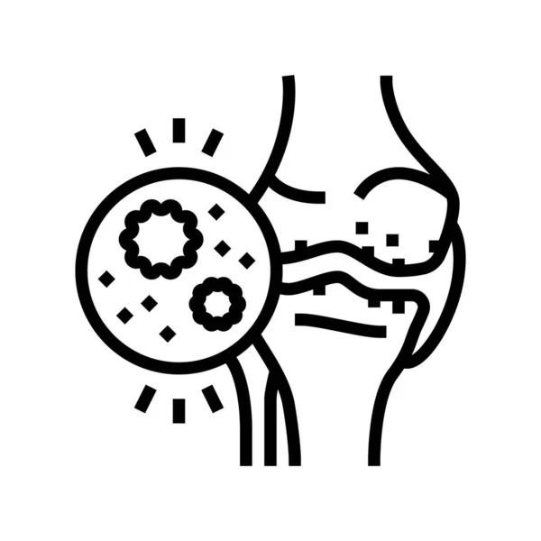 Illustrazione vettoriale dell'icona della linea dell'artrite infettiva — Vettoriale Stock