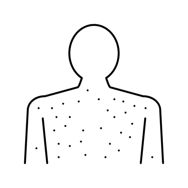 Éruption cutanée maladie ligne icône vectoriel illustration — Image vectorielle