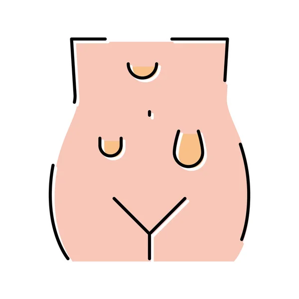 Hernias abdominales enfermedad color icono vector ilustración — Archivo Imágenes Vectoriales