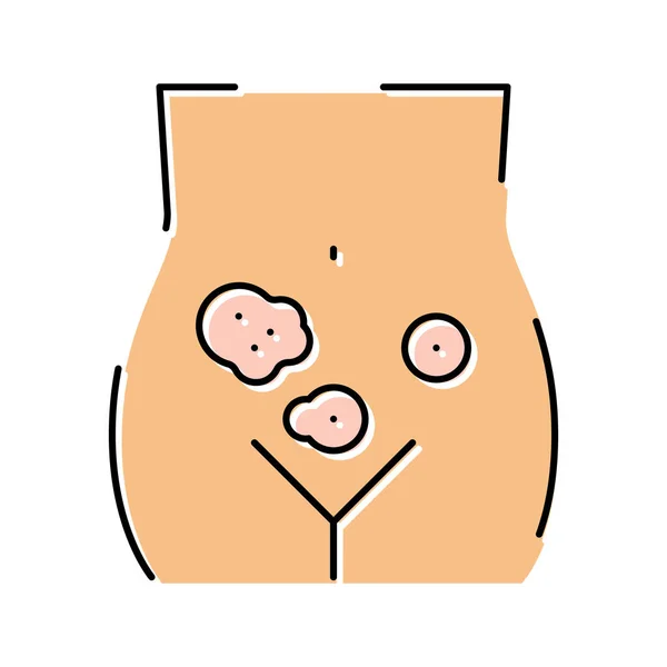 Dermatología genital clínica color icono vector ilustración — Vector de stock