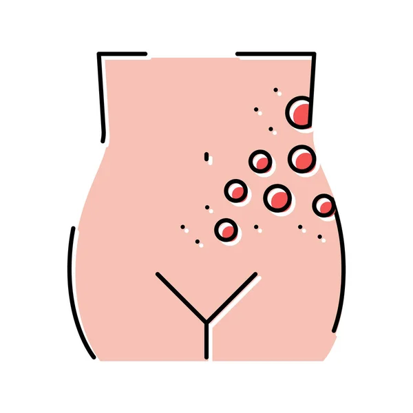 Lichene herpes zoster malattia colore icona vettoriale illustrazione — Vettoriale Stock