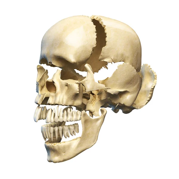 Human skull exploded on parts — Stock Photo, Image