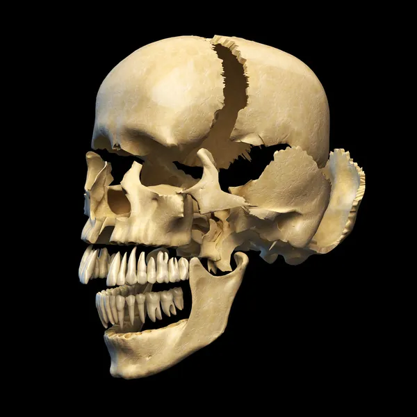 Human skull with parts exploded. — Stock Photo, Image