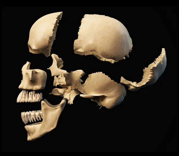 Human skull disassembled on parts. — Stock Photo, Image