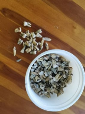 İstenmeyen çürük insan dişleri.. 