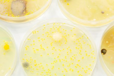 Macro mold and bacterai colonies growing on an agar plates. clipart