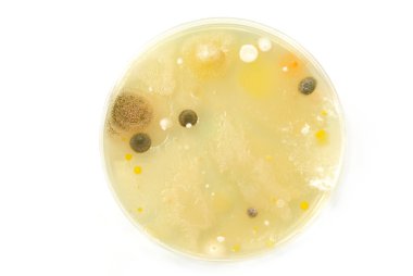 Makro kalıp ve bacterai kolonileri agar plakaları üzerinde büyüyen.