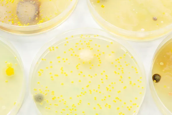 Makroschimmel und Bakterienkolonien, die auf einer Agar-Platte wachsen. — Stockfoto