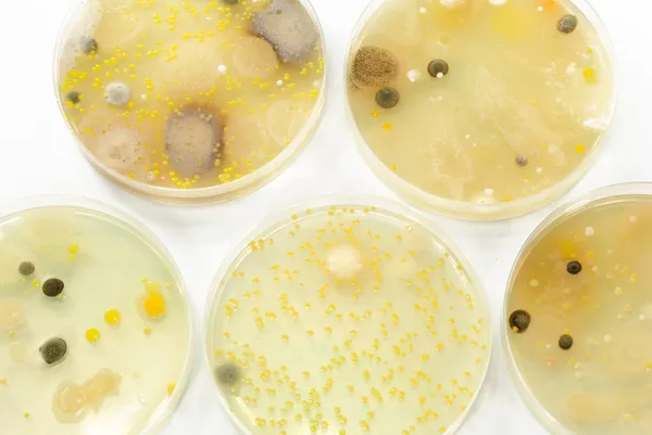 Macro mold and bacterai colonies growing on an agar plates. — Stock Photo, Image