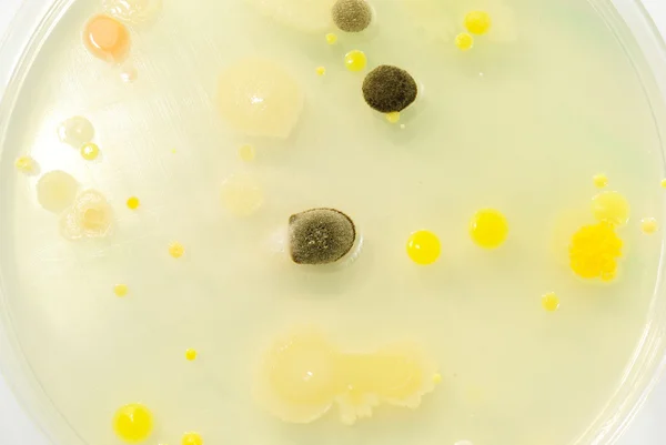 Macro mold and bacterai colonies growing on an agar plates. — Stock Photo, Image