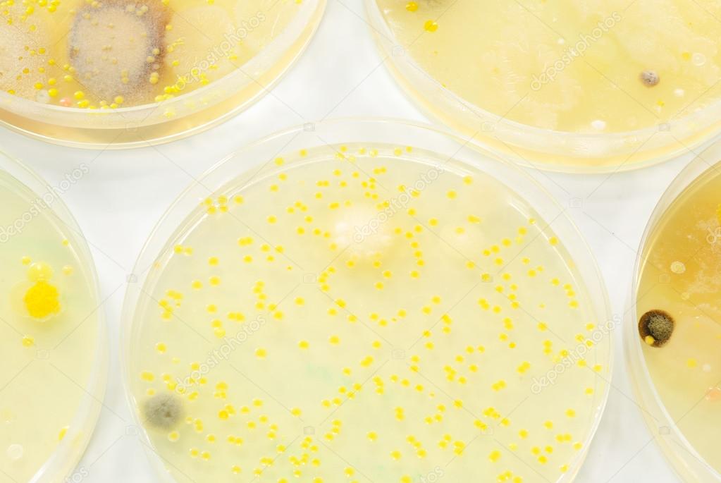Macro mold and bacterai colonies growing on an agar plates.