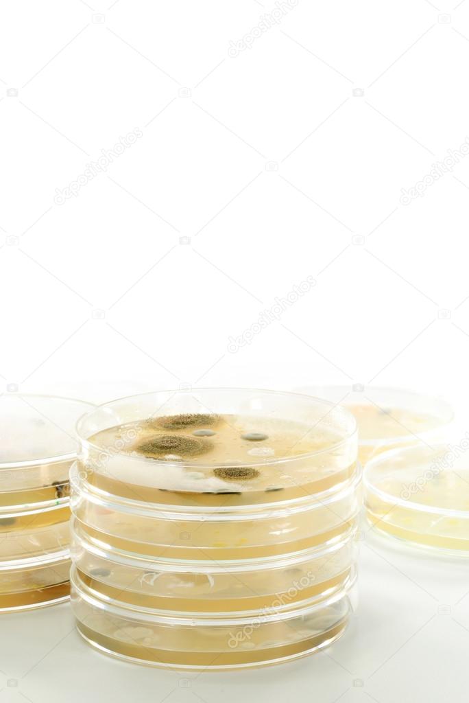 Macro mold and bacterai colonies growing on an agar plates.
