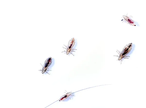 Head lice — Stock Photo, Image