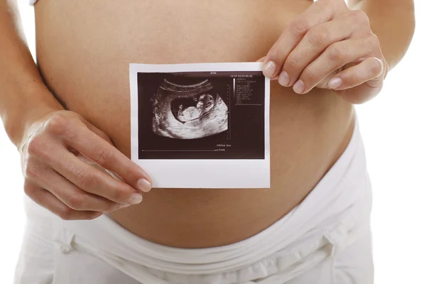 Retrato de uma mulher grávida com ultra-som foto do bebê — Fotografia de Stock