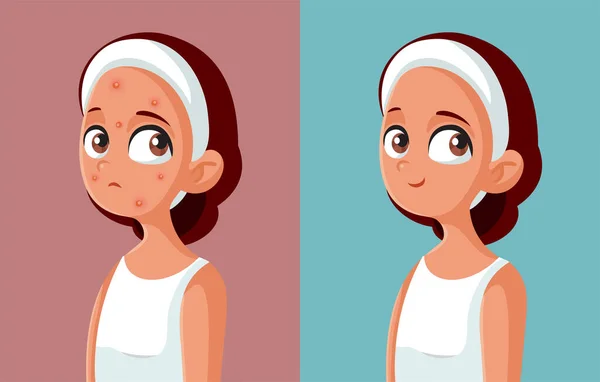Νεαρό Κορίτσι Πριν Και Μετά Θεραπεία Acne Εικονογράφηση Διάνυσμα — Διανυσματικό Αρχείο