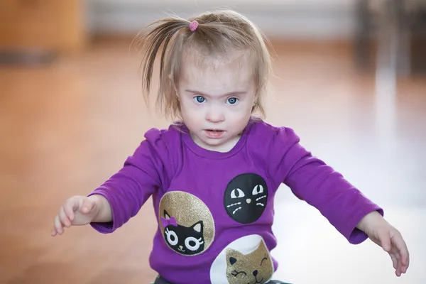 Emotions Down syndrome girl — Stock Photo, Image