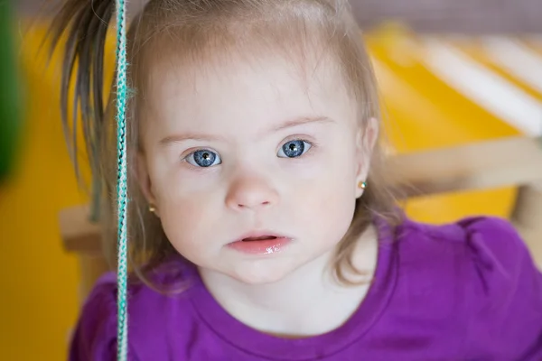 Emocje małej dziewczynki z zespołem Downa — Zdjęcie stockowe