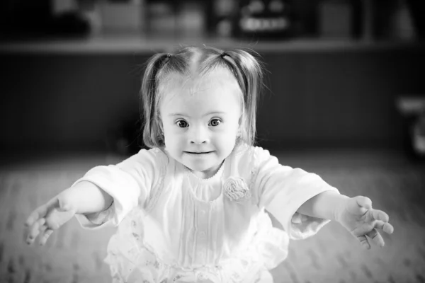 Emociones síndrome de Down chica —  Fotos de Stock