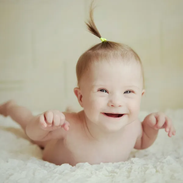 Kleines Mädchen mit Down-Syndrom — Stockfoto