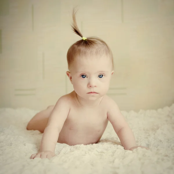 Little girl with Down syndrome — Stock Photo, Image