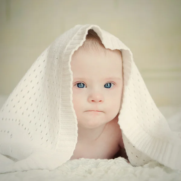 Small serious baby with Down syndrome hid under blanket — Stock Photo, Image