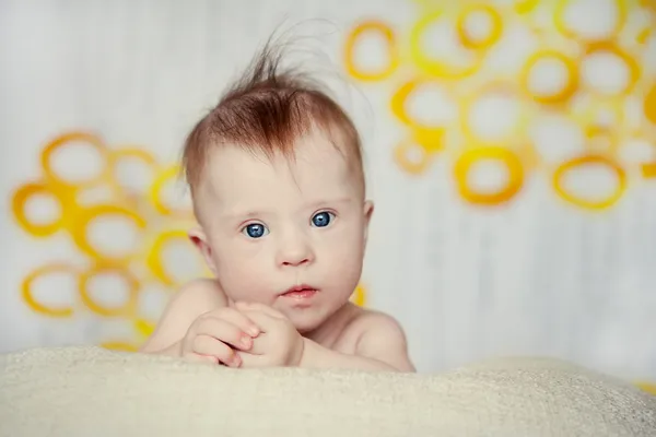 Veselá malá holčička s downs syndrom — Stock fotografie